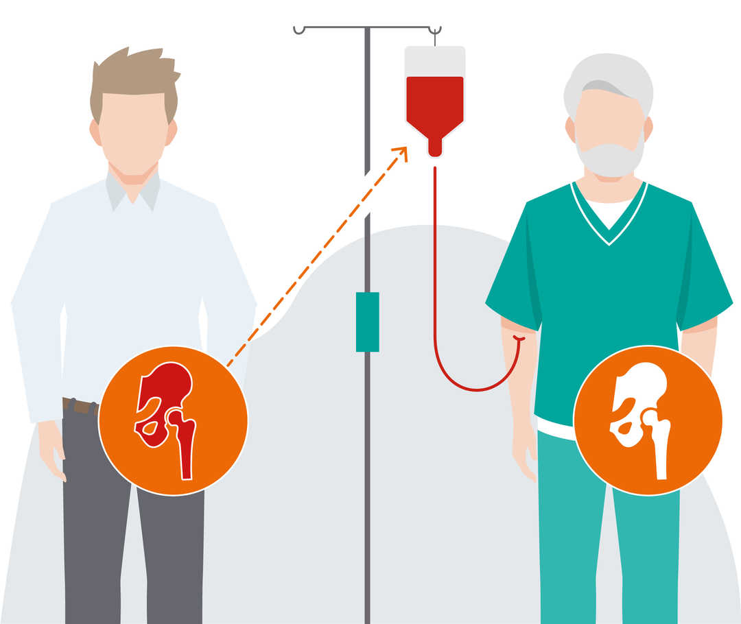 Leben mit CML: Wissen über CML Darstellung der Blutstammzell-Transplantation